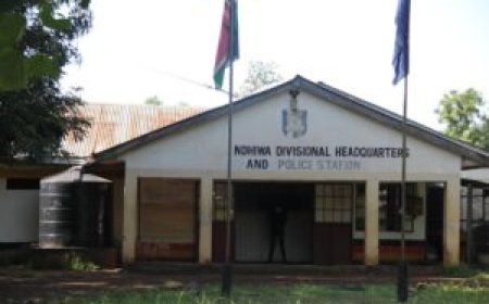 Mother Burns Son's Hands for Stealing 50 Bob.